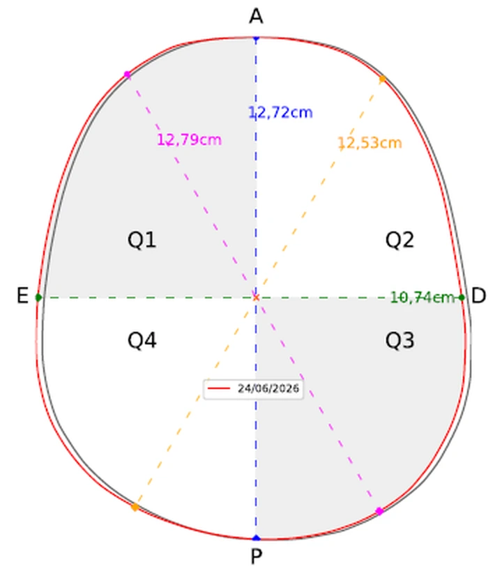 Mapa de assimetria craniana por quadrantes